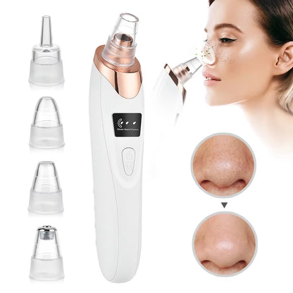 Blackhead Remover Vacuum Pore Adsorber Face Cleaner