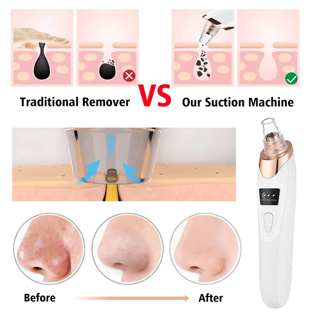 Blackhead Remover Vacuum Pore Adsorber Face Cleaner