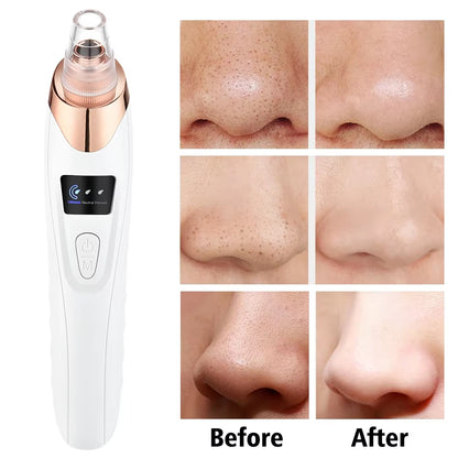 Blackhead Remover Vacuum Pore Adsorber Face Cleaner